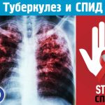 В Волгоградской области пациенты с туберкулезом и ВИЧ получают эффективную помощь