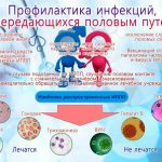 Профилактика инфекций, передающихся половым путем